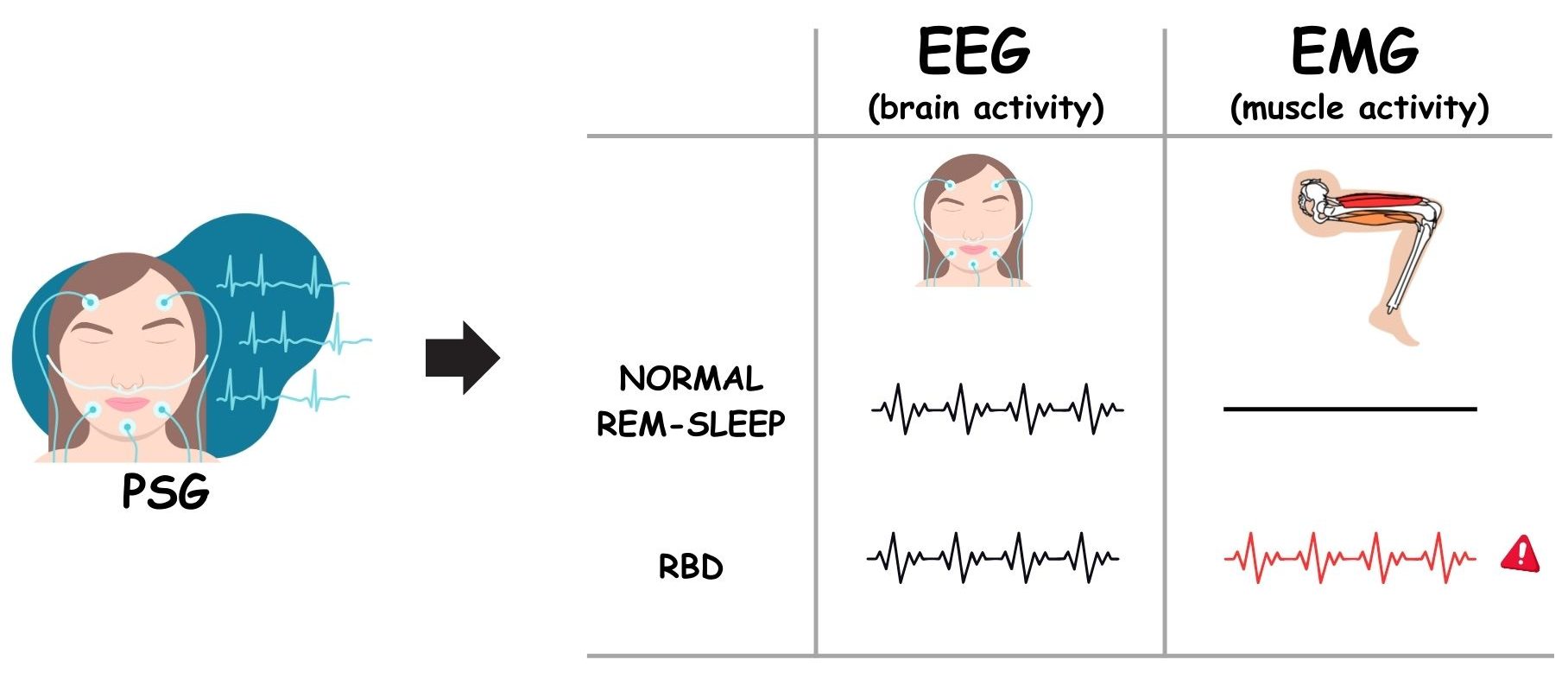 cropped-RBD-diagnosis-fig.jpg